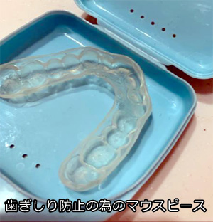 歯ぎしり防止のためのマウスピース